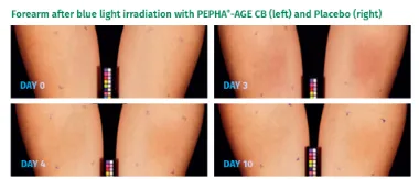 Comparative before/after study of cosmetics treatment on skin, progression over 10 days with PEPHA-AGE ingredient